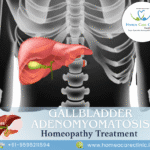 gallbladder adenomyomatosis