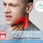 White Spots on Tonsils